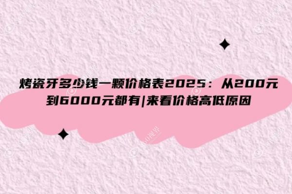 烤瓷牙多少钱一颗价格表2025：从200元到6000元都有|来看价格高低原因
