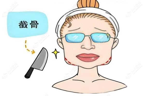 重庆正颌手术做得好的医生.jpg