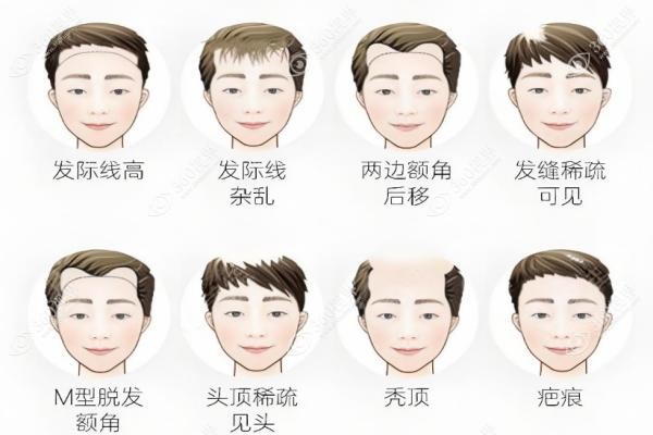 南京建国领秀植发医院价格表.jpg