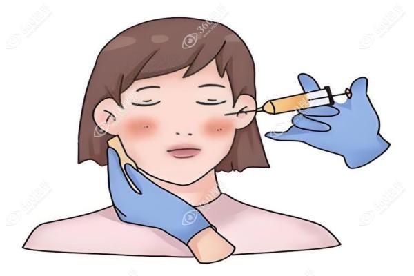 乔雅登玻尿酸正 品价格大揭秘：2500元是正规么？5大系列价格+避坑指南!2