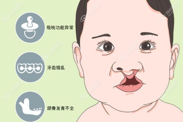 八大处唇腭裂整形科哪个医生好？从医生排名查询侯典举|田孝臣做的好
