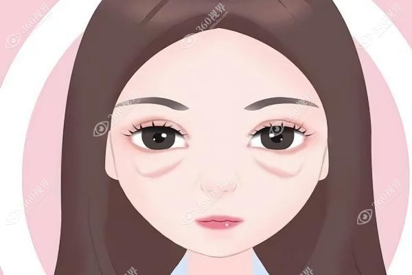 外切眼袋加中面部提升效 果好吗.jpg