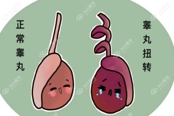 国内切除睾丸手术医生排名榜