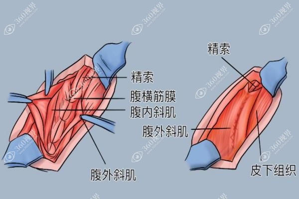 国内切除睾丸手术哪个医院好
