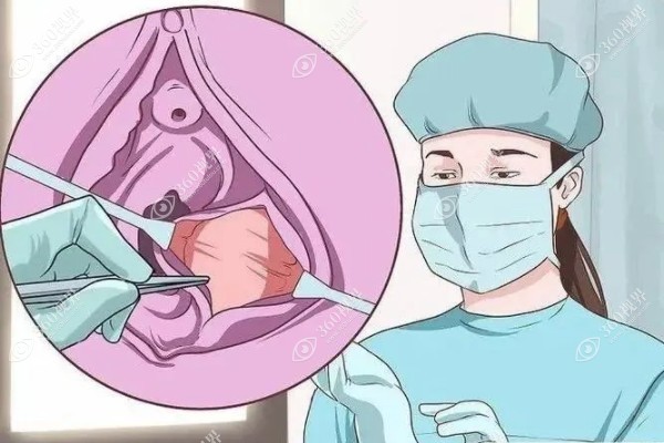 成都私密整形医生排名