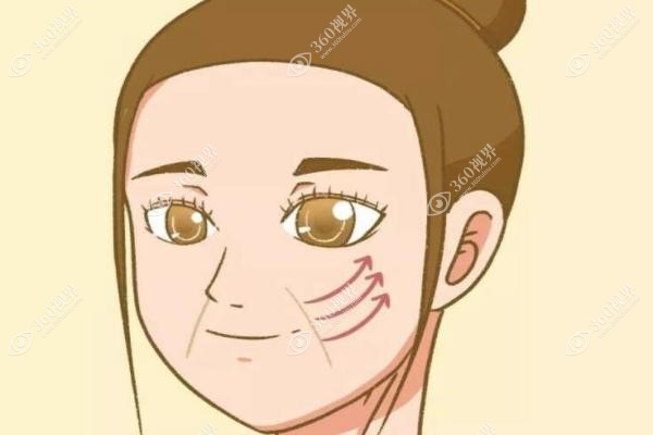 做过拉皮手术的真实感受.jpg