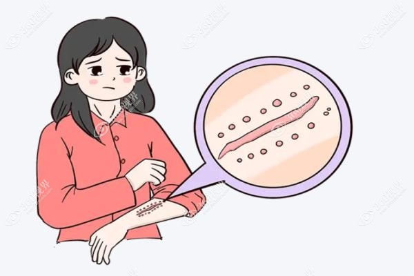 贵阳疤痕医院排名.jpg