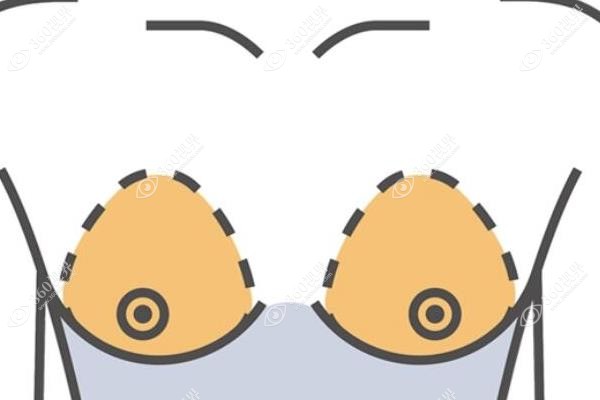 乳晕缩小手术以后还能哺乳吗?通常不影响哺乳且不会因哺乳变大反弹,价格在5k-1w左右.jpg