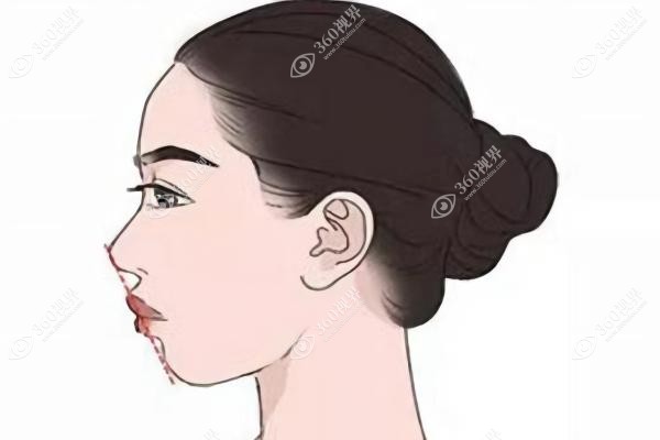 国内正颌医院推荐.jpg