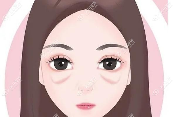 吕方中医生修复双眼皮怎么样