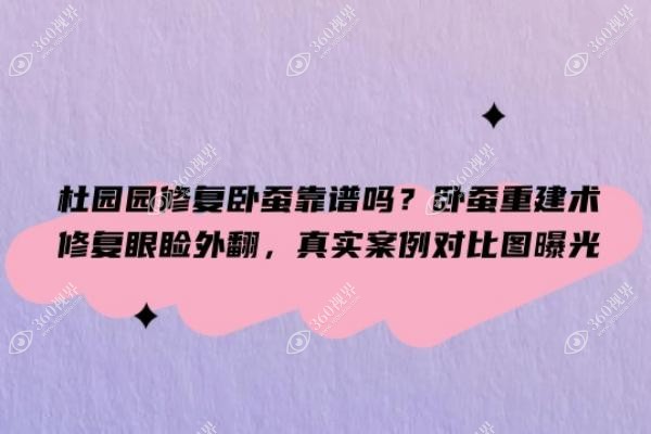 杜园园修复卧蚕靠谱吗？卧蚕重建术修复眼睑外翻，真实案例对比图曝光
