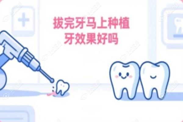 拔完牙马上种植牙<span style=