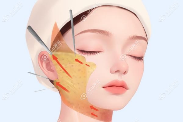 贵阳面部拉皮手术去哪家整形医院好？利美康/必妩/美莱做的好-价格透明