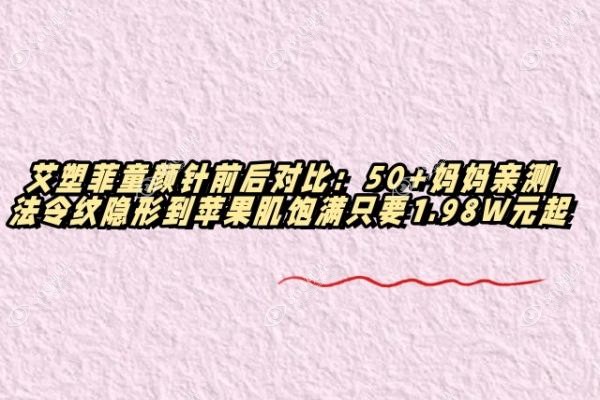 艾塑菲童颜针前后对比：50+妈妈亲测法令纹隐形到苹果肌饱满只要1.98W元起