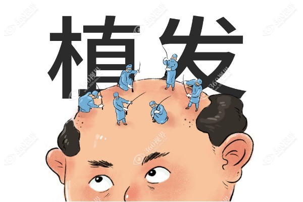 国内植发医院哪个好.jpg