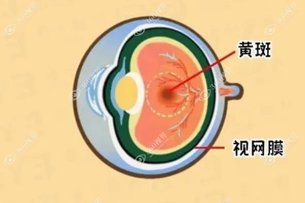 眼底黄斑病变打针需要住院治疗吗?