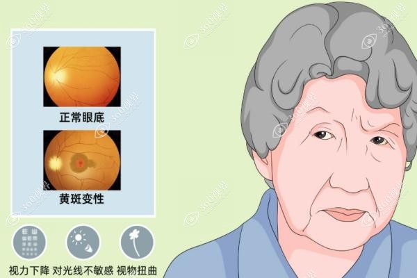眼底黄斑病变一针多少钱