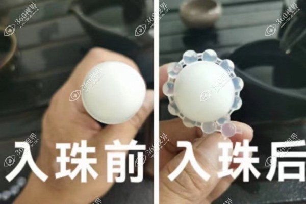 入珠的人讲一下感触
