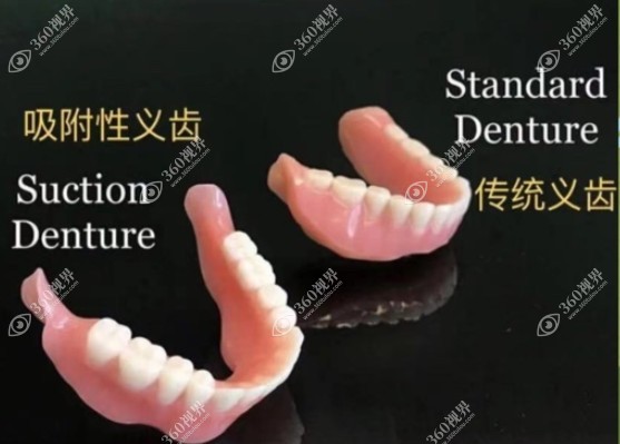 吸附性义齿和普通义齿有啥区别？