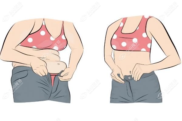 腹部拉皮手术价格一览表.jpg