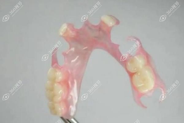 吸附性义齿牙的优缺点