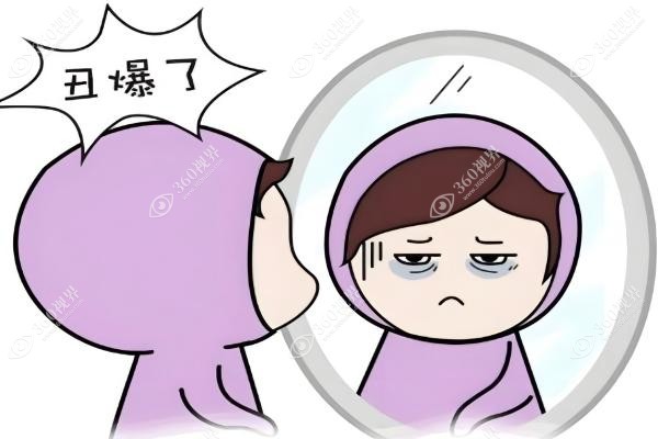 昆明割眼袋医生推荐.jpg