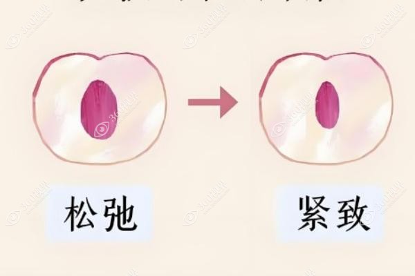 国内紧缩手术医院哪家好.jpg