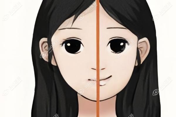 左右脸不对称颧骨一高一低怎么矫正？从形成原因到改善矫正方法一一详解