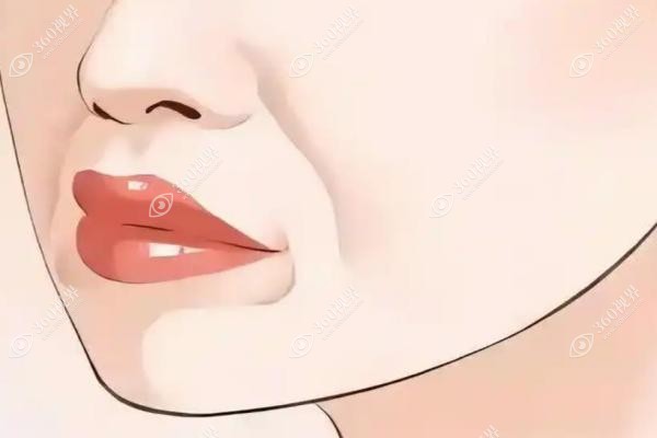 ADM鼻基底是什么？生物再生材料+维持长效派,附填充价格一览