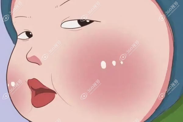 馒化脸哪个医生做的好？馒化脸修复好的医生首选蒋铮铮!