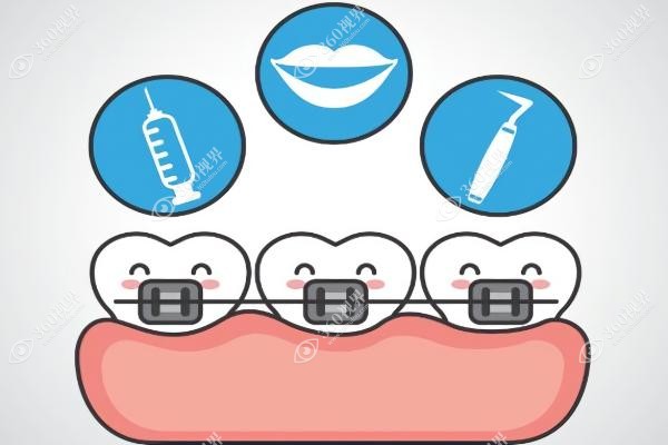 正雅隐形矫正效 果怎么样.jpg