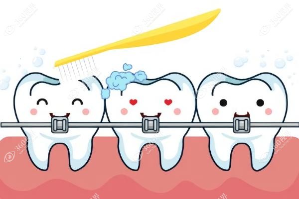 正雅隐形矫正官网价格：含悦享版/标准版等多系列价格表及效果一览