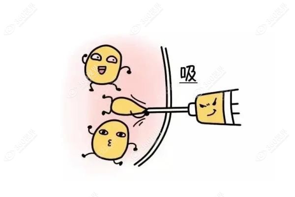 赵军舰和王阳医生哪个更好?传统吸脂vs精细雕刻+口碑真实测评.jpg
