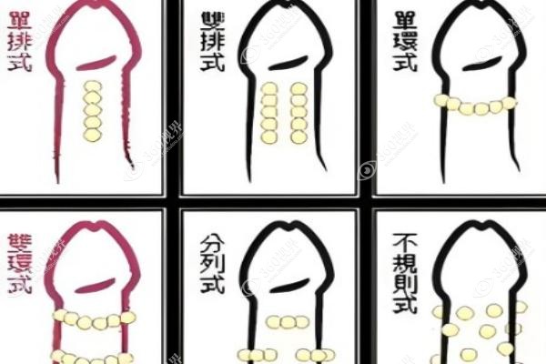 男士入珠手术医院哪家好.jpg