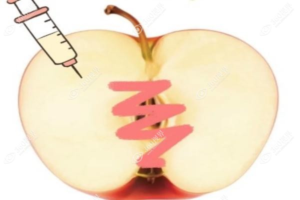 私处松弛做激光紧缩术好吗