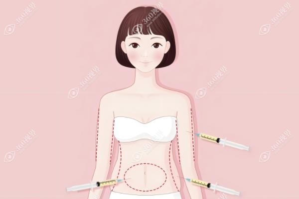 杭州彭涛属于哪个医院的医生?现坐诊杭州格莱美,FSE分层抽脂技术强.jpg