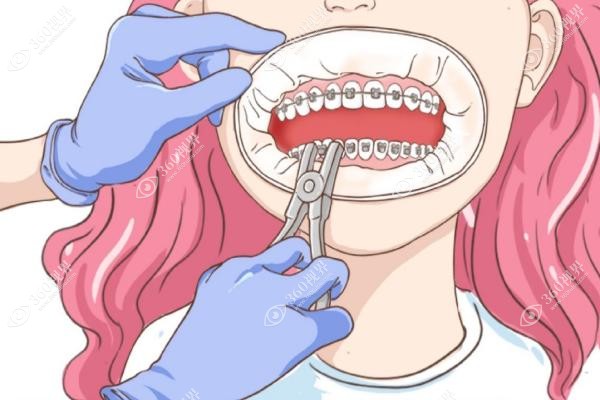 成都布莱梅的口碑怎么样.jpg 成都布莱梅的口碑怎么样.jpg