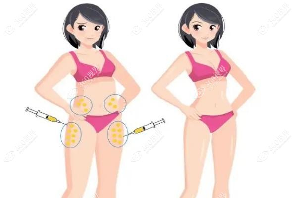 王明利医生做脂肪填充多少钱