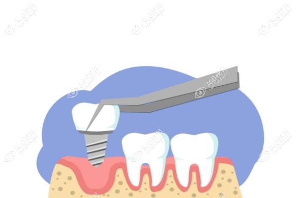 南阳植得口腔医院价格表.jpg 南阳植得口腔医院价格表.jpg
