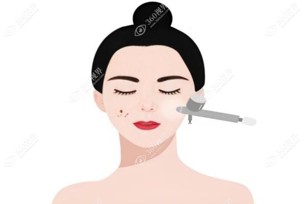韩国Shinebom皮肤科评价如何?网友反馈金院长注射水平高可线上预约.jpg