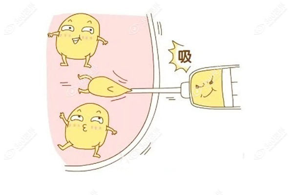 腹部环吸抽脂手术后的真实感受.jpg