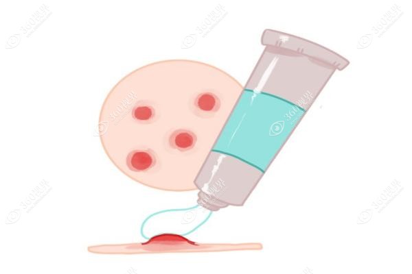 悦龄塑骨胶原一支多少钱？9800元起，灵悦9k起18个月全吸收！材料安全揭秘