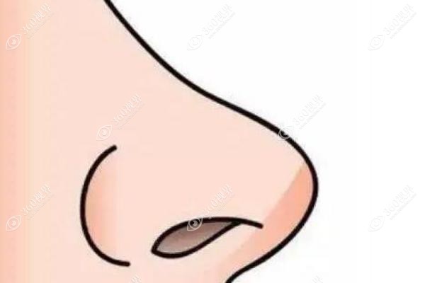 硅胶隆鼻好还是膨体好？硅胶隆鼻VS隆鼻效果|维持时间|价格便知哪个好