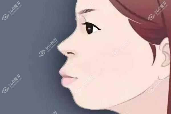 吴中兴正颌手术技术怎么样？微创数字化+微创正颌效果真的好!附个人案例简介