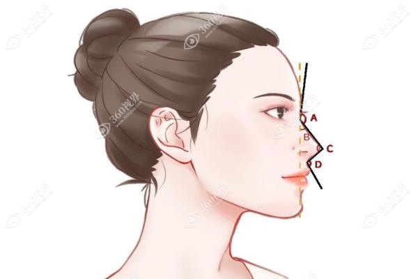 肋软骨隆鼻有什么风险和后遗症.jpg