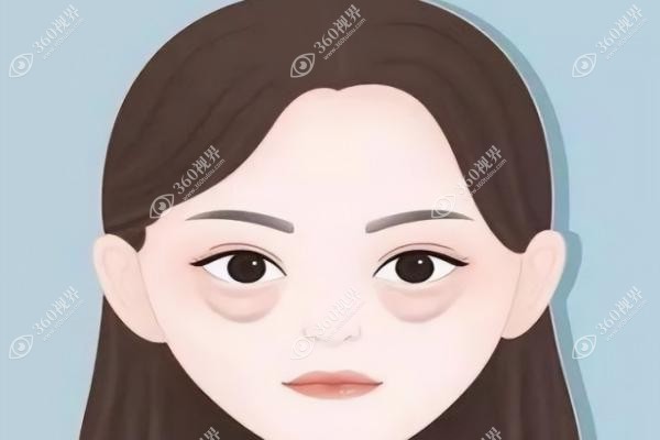 佀同帅擅长哪种双眼皮？全切双眼皮&修复案例大公开，修复眼睛好到爆~