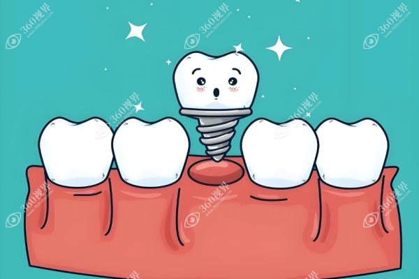 罗恩正颌手术怎么样？亲历者分享恢复快值得做，术后10天重返职场