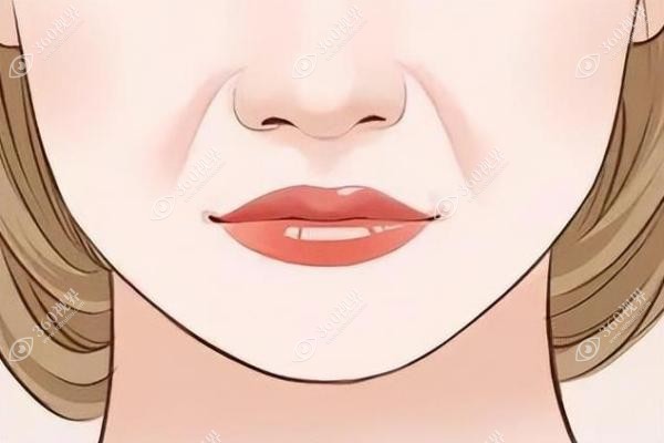 法令纹用什么玻尿酸比较好？乔雅登|润百颜|艾莉薇等填充效果好,自然不易移位！