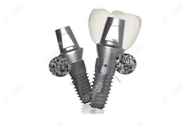 奥齿泰种植牙是什么材质 奥齿泰种植牙是什么材质