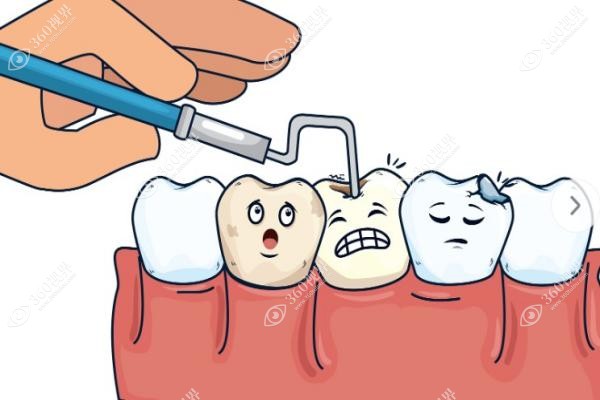 瑞典astra种植体的拉升强度 瑞典astra种植体的拉升强度